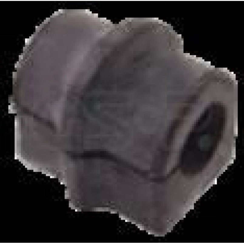 516796 GSP - Втулка стабілізатора